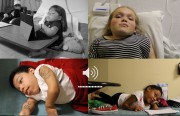 Faces of Morquio patients